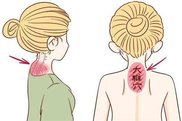 富貴包會造成手腳發(fā)麻嗎 富貴包導致手麻怎么辦