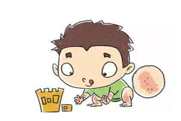 小兒風(fēng)疹怎么止癢 小兒風(fēng)疹怎么護理