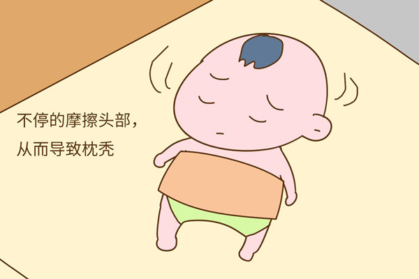 嬰兒枕禿要緊嗎 嬰兒枕禿多久恢復(fù)正常