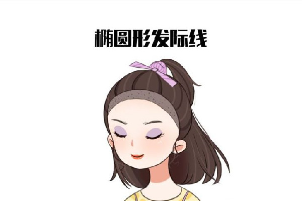 發(fā)際線后移怎么恢復 發(fā)際線后移是什么原因引起的