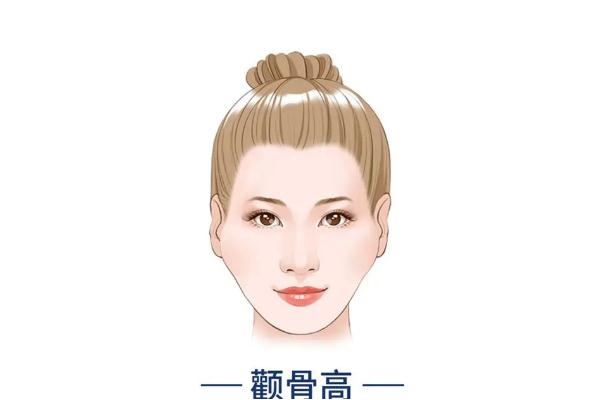 顴骨內(nèi)推要開刀嗎 顴骨內(nèi)推有生命危險嗎